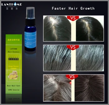 2vnt Vaistažolių Greitai Plaukų Augimo Serumas Naftos Alopecija Stabdžių Nuplikimas Esmė Plaukų Slinkimas Spray Plaukų Atauga Apdorojimo Produktai Vyrai Moterys